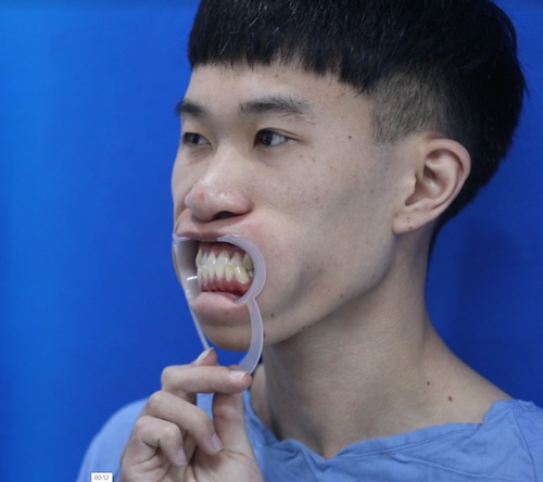 hành trình lột xác mùa 4