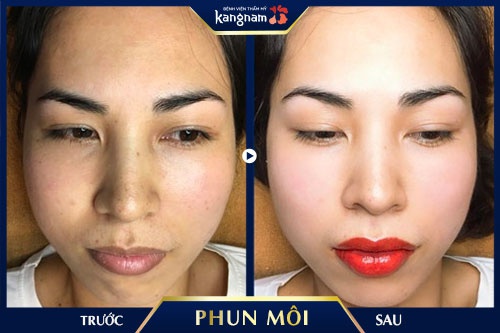 phun môi tế bào gốc màu đỏ cam 