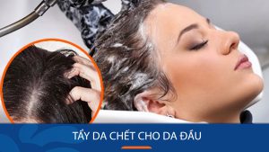 Tẩy da chết cho da đầu – Bí quyết cho mái tóc dài mượt như nhung