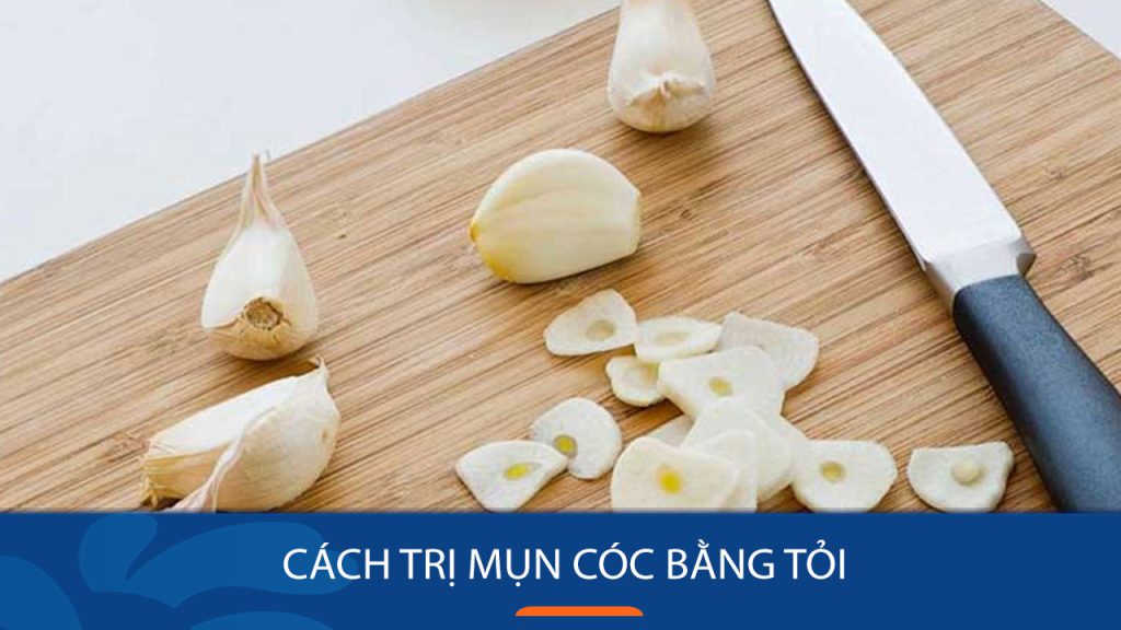 [Giải Pháp Hoàn Hảo] Trị Mụn Cóc Bằng Tỏi – Nhanh Chóng, An Toàn