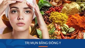 Trị Mụn Hiệu Quả Bằng Đông Y An Toàn, Không Tái Phát