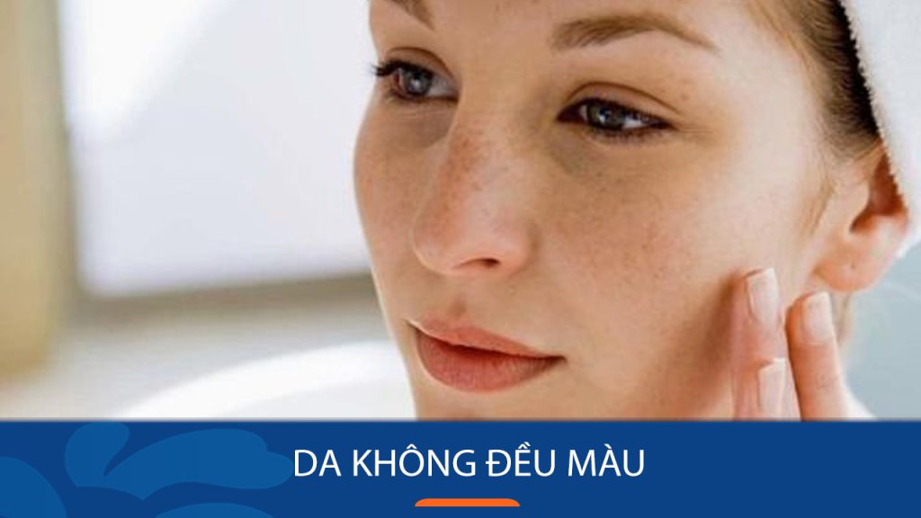 Da không đều màu phải làm sao? 4 Cách làm đều màu da nhanh