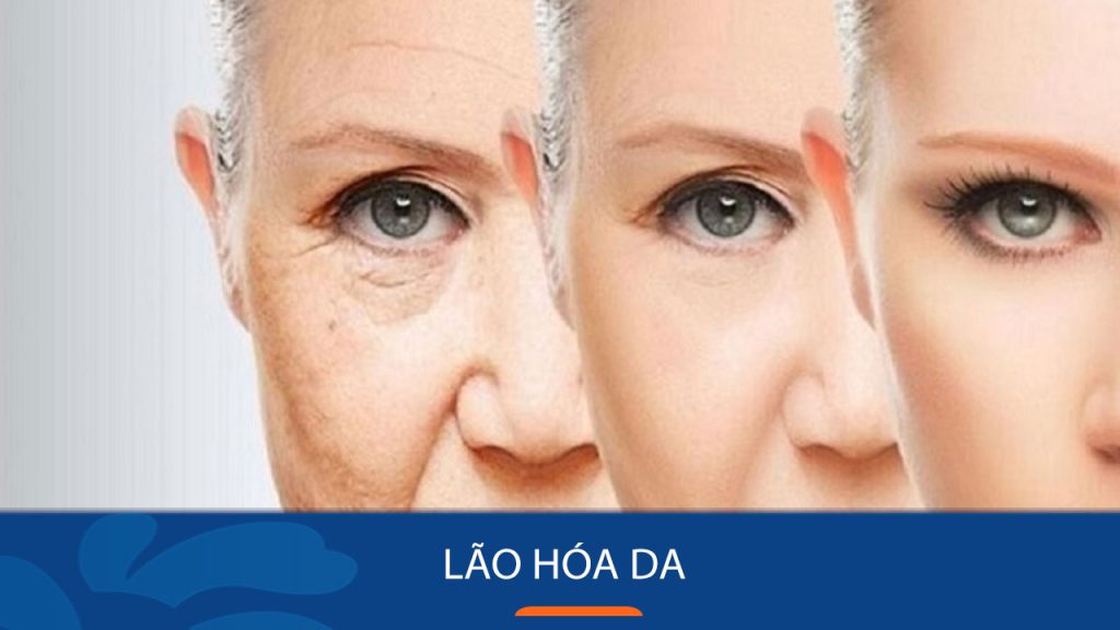 Lão Hóa Da: Nguyên nhân, Dấu hiệu & Bí quyết phòng chống