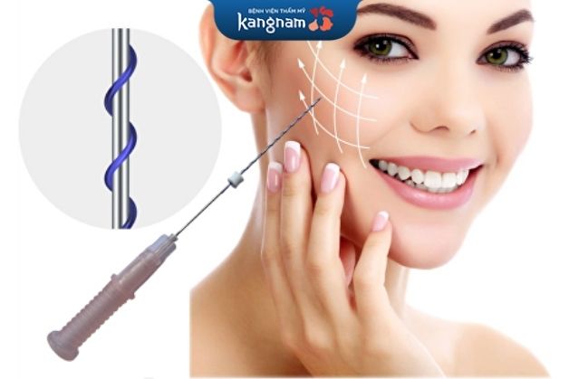 Có nên căng da mặt bằng chỉ collagen không?