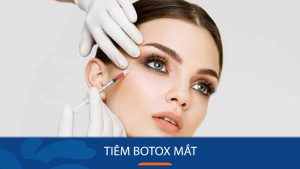 Tiêm botox xóa nếp nhăn vùng mắt – Cẩm nang làm đẹp