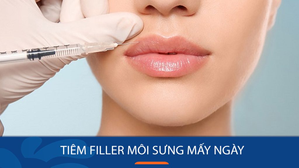 Tiêm Filler Môi sưng mấy ngày? Cần lưu ý gì để môi mau hết sưng?
