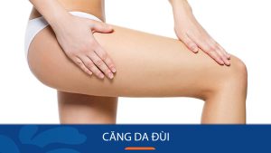 Căng da đùi: Giải pháp thẩm mỹ hiện đại níu giữ tuổi trẻ