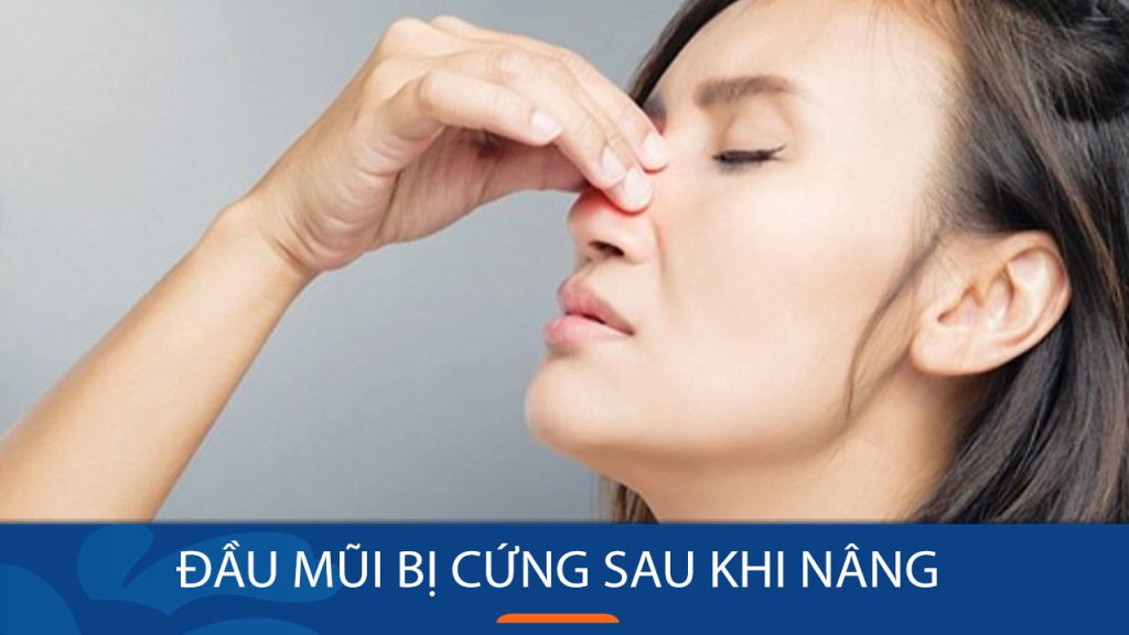 Đầu Mũi Bị Cứng Sau Khi Nâng: Nguyên nhân & Cách khắc phục