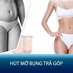 Hút mỡ bụng trả góp 0%: Sự thật hay chỉ là Chiêu trò truyền thông