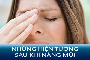 Những hiện tượng sau khi nâng mũi thường gặp và cách xử lý