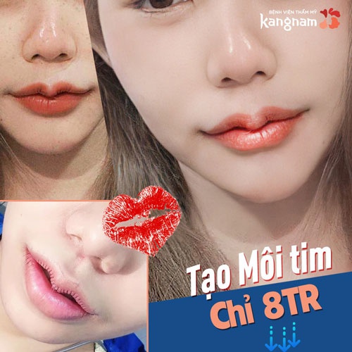 tạo hình môi trái tim