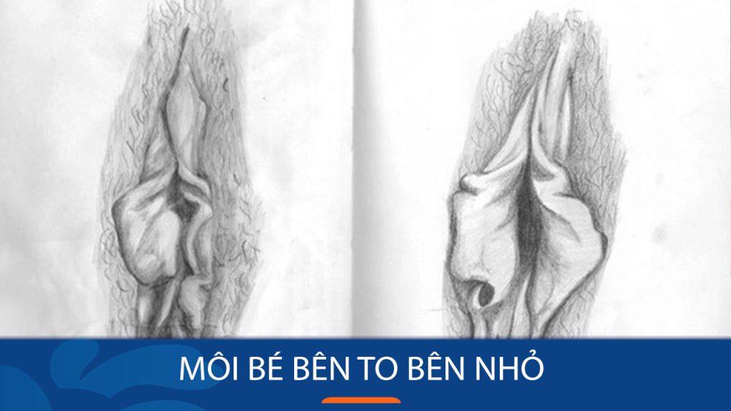 Môi bé bên to bên nhỏ: Nguyên nhân, ảnh hưởng và cách khắc phục