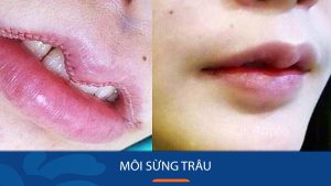 Môi Sừng Trâu: Giải mã tướng mặt, luận giải phong thủy 99% chính xác