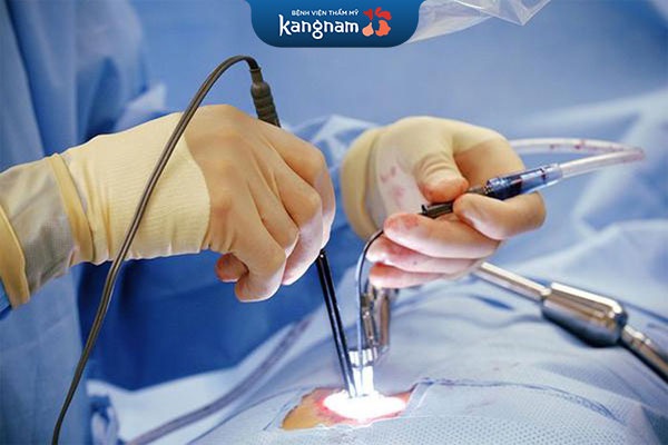 quy trình phẫu thuật căng da bụng