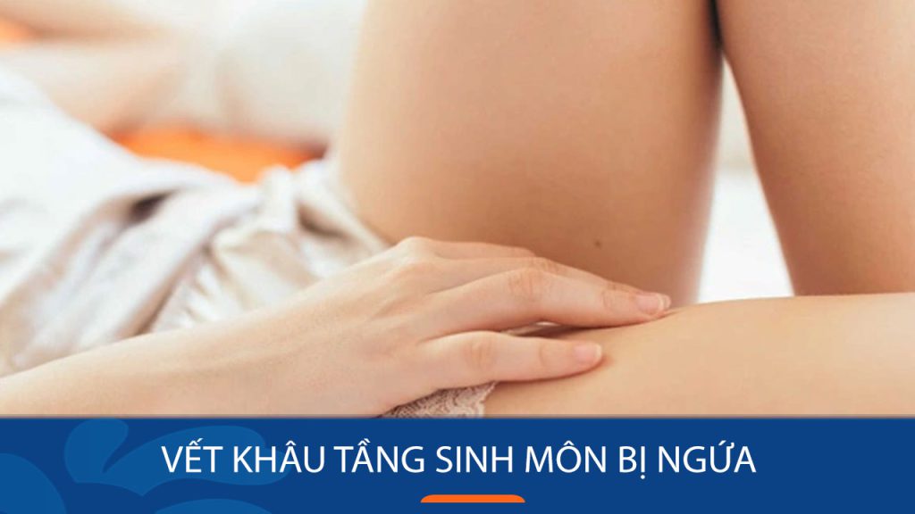 Vết khâu tầng sinh môn bị ngứa: Nguyên nhân và cách giảm ngứa an toàn