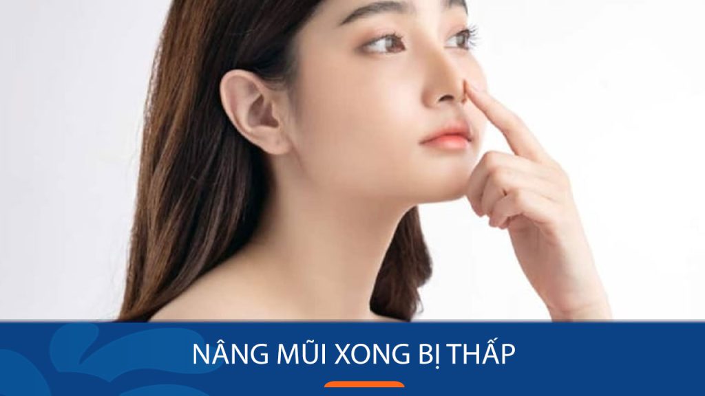 Nâng Mũi Xong Bị Thấp: Nguyên nhân và cách khắc phục hiệu quả