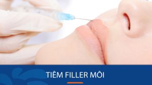 Tiêm Filler môi là gì? Bật mí những dáng môi hot trend 2024 và cách tiêm filler để sở hữu