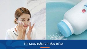 Bí quyết trị mụn thần tốc bằng phấn rôm, da mịn màng không tì vết chỉ sau 1 tuần