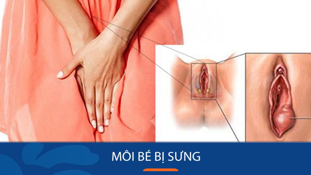 Môi Bé Bị Sưng: Bí quyết giảm sưng đau môi bé trong 24h