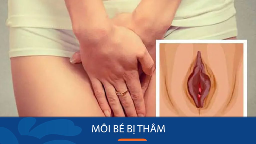 Tại Sao Môi Cô Bé Bị Thâm? 7 Cách Lấy Lại Sắc Hồng Tự Nhiên Hiệu Quả