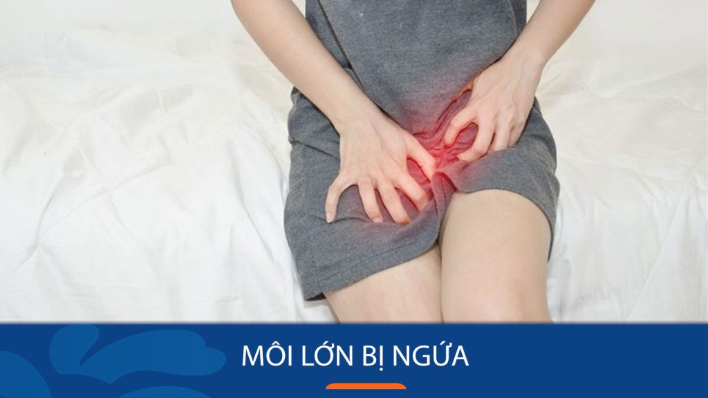 Vì sao môi lớn bị ngứa? Nguyên nhân và giải pháp điều trị nhanh chóng