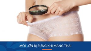 Bí quyết giảm sưng môi hiệu quả cho phụ nữ mang thai