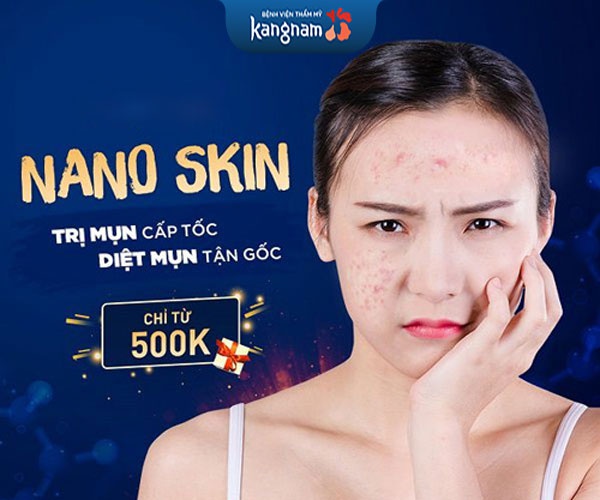 trị mụn nano skin tại kangnam