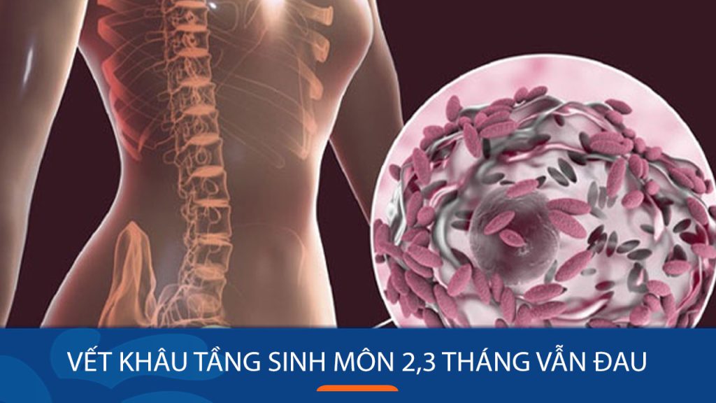 Vết khâu tầng sinh môn sau sinh 2-3 tháng vẫn chưa lành: Cách khắc phục an toàn