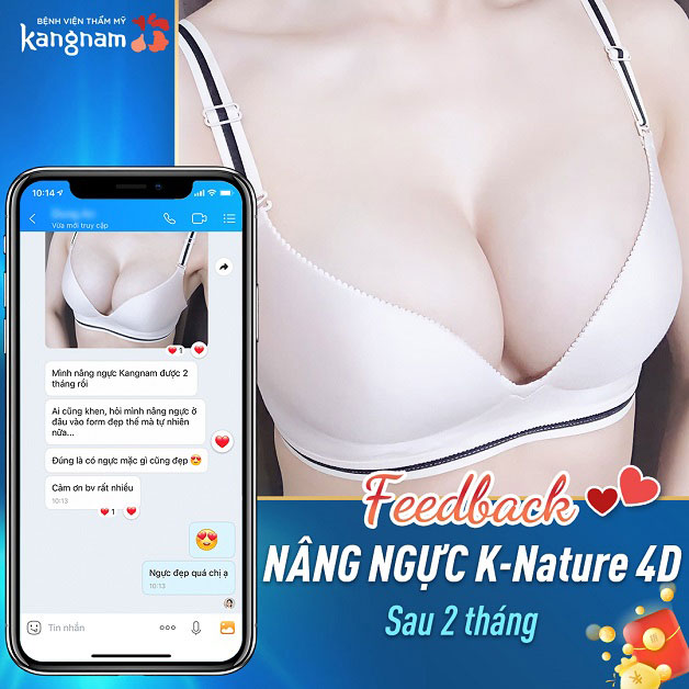 Khách hàng nâng ngực K - Nature 4D sau 2 tháng 