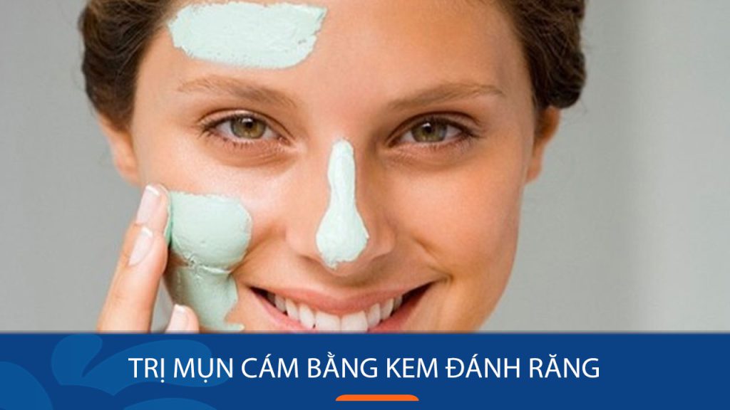 Bí quyết trị mụn cám DỨT ĐIỂM với kem đánh răng – Hiệu quả chỉ sau 15 phút