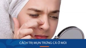 Cách trị mụn trứng cá ở mũi hiệu quả nhanh chóng: Loại bỏ mụn trứng cá ở mũi tận gốc