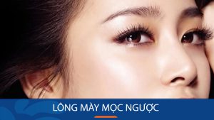 Lông Mày Mọc Ngược: Bí Mật Vận Số & Giải Pháp Hiệu Quả