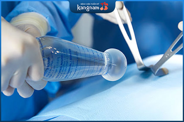 Sử dụng túi nước biển khi nâng ngực