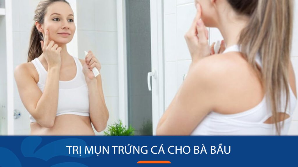 5 Bí quyết trị mụn trứng cá cho bà bầu an toàn và hiệu quả