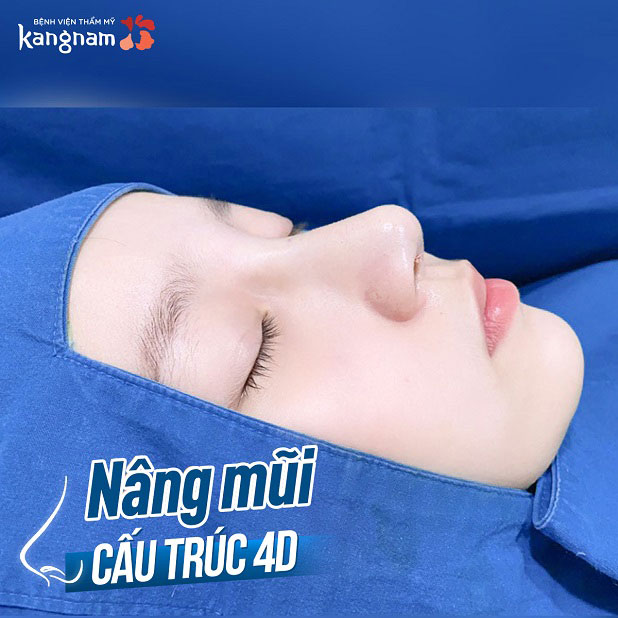 Khách hàng sau khi nâng mũi cấu trúc 