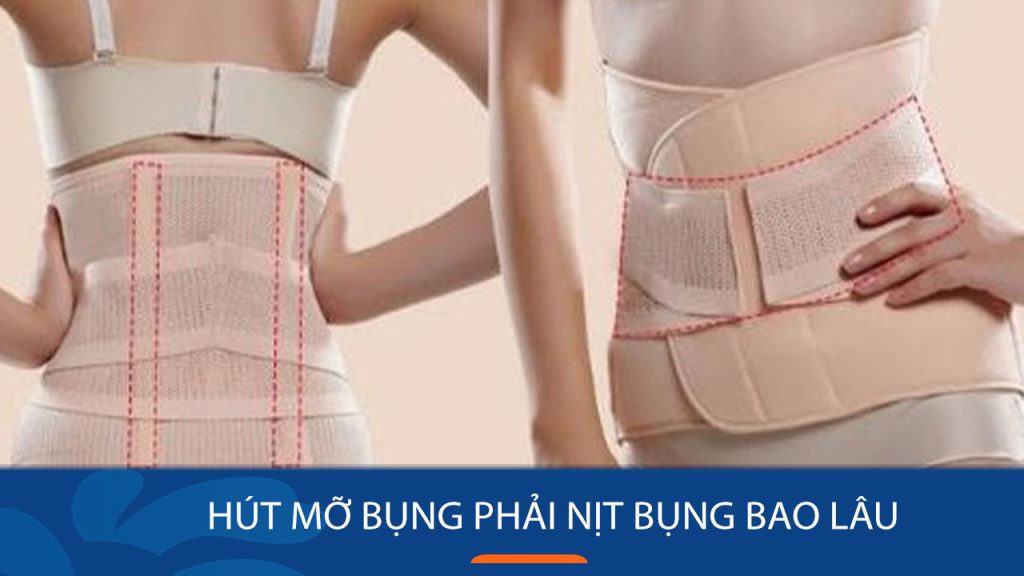 Hút mỡ bụng phải nịt bụng bao lâu? cần chú ý điều gì