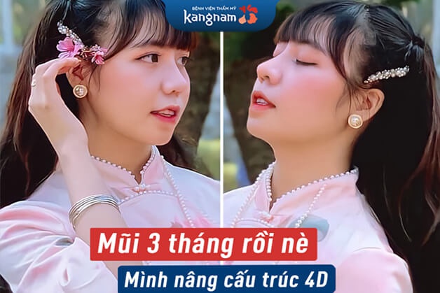 Lựa chọn địa chỉ nâng mũi cấu trúc uy tín