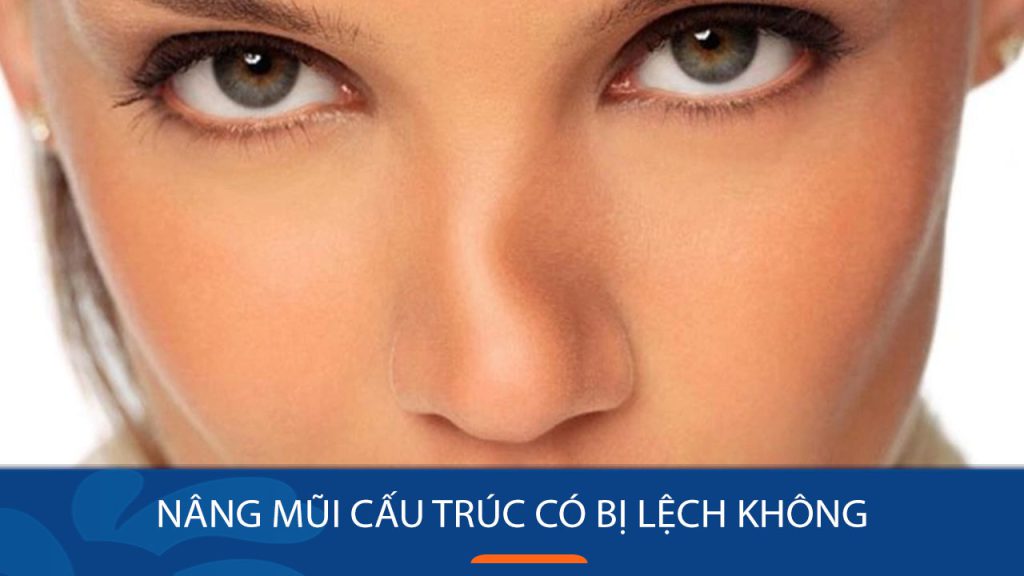 Nâng mũi cấu trúc có bị lệch không? Giải pháp khắc phục ra sao?