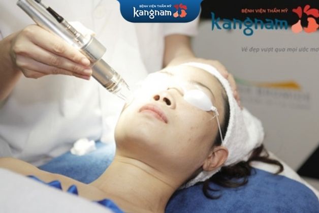 Quy trình trẻ hóa da bằng laser tại Kangnam theo đúng quy trình chuẩn của Bộ Y tế