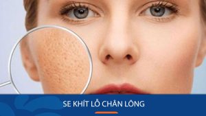 Cách Se Khít Lỗ Chân Lông Hiệu Quả Tại Nhà – Nhanh Chóng – An Toàn