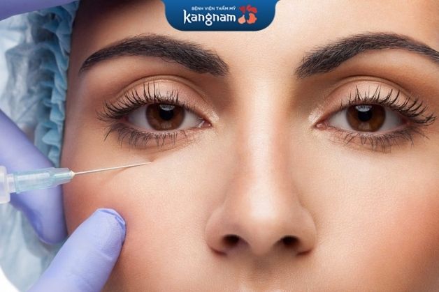 Tiêm botox ngăn ngừa lão hóa mắt sớm