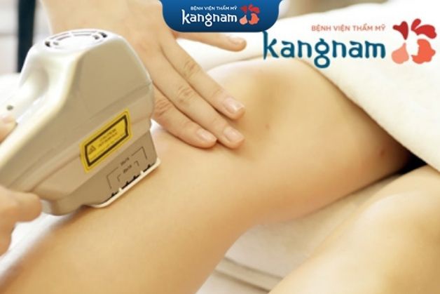 Kangnam là đơn vị triệt lông an toàn, hiệu quả