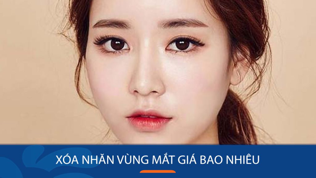 Xóa nhăn vùng mắt giá bao nhiêu? Bảng giá cập nhật