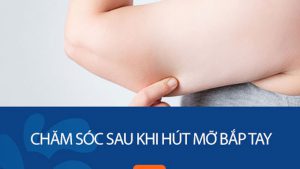 Chăm sóc sau khi hút mỡ bắp tay: 4 Bí kíp cần biết