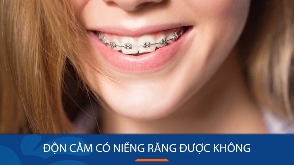 Độn cằm có niềng răng được không? [Kangnam Giải đáp]
