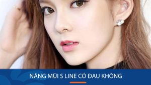 Nâng mũi S line có đau không? Giải đáp từ Bác sĩ Kangnam