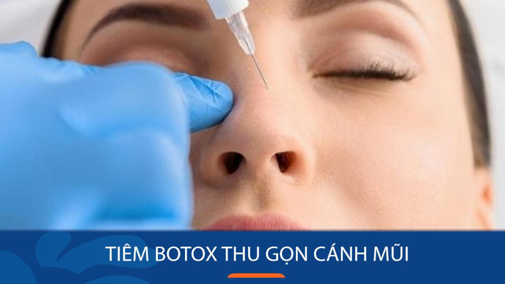 Tiêm Botox Thu Gọn Cánh Mũi: Giải Pháp Nhanh Chóng Cho Dáng Mũi Thanh Tú