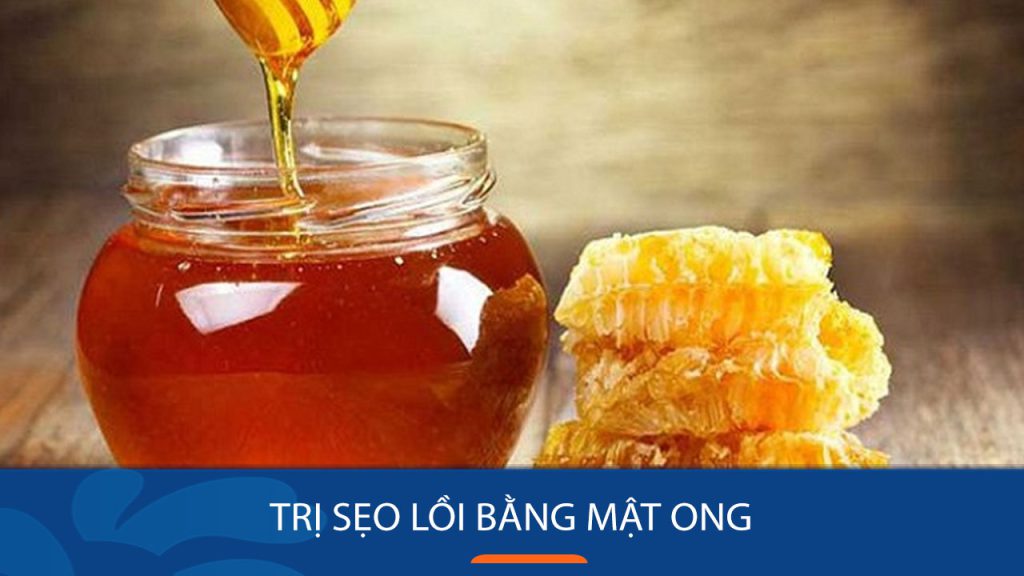 Trị sẹo lồi tận gốc bằng mật ong: 6 công thức hiệu quả & Bí quyết thành công