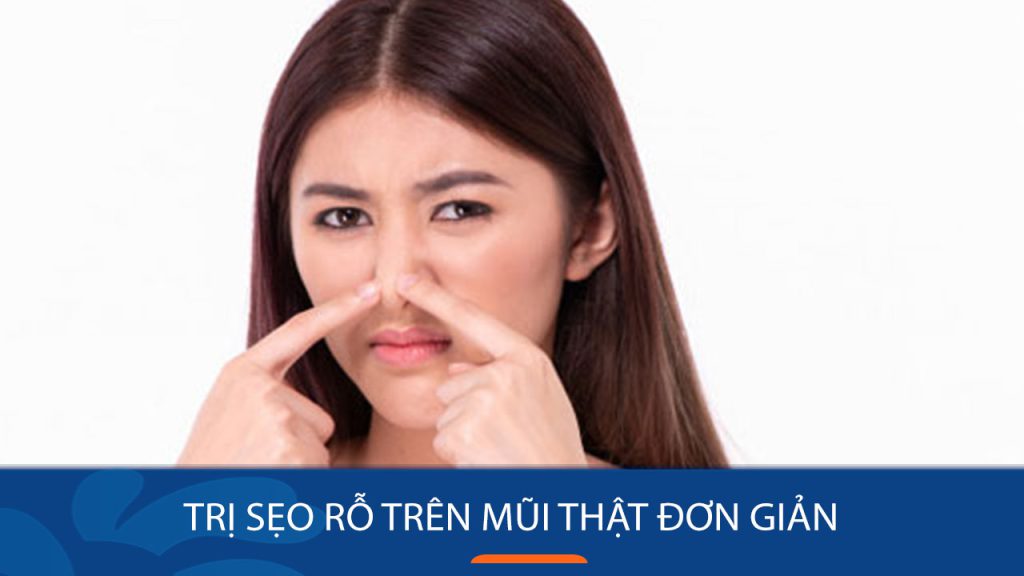 Trị sẹo rỗ trên mũi: Hết lo sẹo rỗ mũi với 5 phương pháp đơn giản