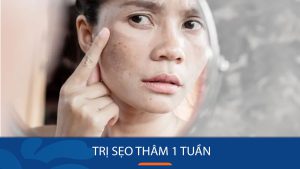 9 Cách Trị Sẹo Thâm Hiệu Quả Chỉ Trong 1 Tuần – Bí Quyết Làm Đẹp Da